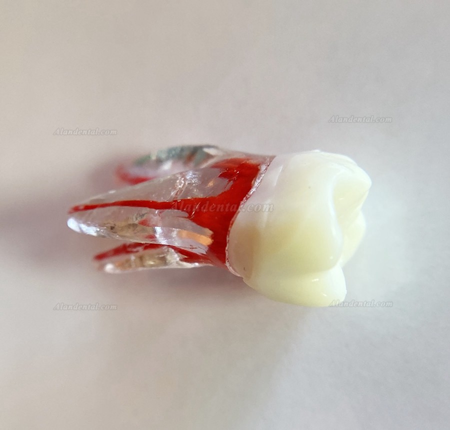 Dental Teeth Model Endo Files Practise Molar Upper Lower Tooth Premolar Root 2/3-Rooted Canal